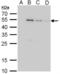 Glutathione S-Transferase Mu 1 antibody, NB600-446, Novus Biologicals, Western Blot image 