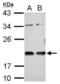 Vasohibin 1 antibody, NBP2-20845, Novus Biologicals, Western Blot image 