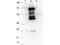 Borrelia burgdorferi antibody, NBP2-21650, Novus Biologicals, Western Blot image 