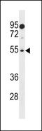 PRAME Family Member 18 antibody, PA5-49179, Invitrogen Antibodies, Western Blot image 