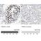TOP2A antibody, NBP1-86928, Novus Biologicals, Immunohistochemistry paraffin image 
