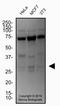 Cbp/P300 Interacting Transactivator With Glu/Asp Rich Carboxy-Terminal Domain 2 antibody, NB100-136, Novus Biologicals, Western Blot image 