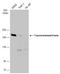 DNA Topoisomerase II Beta antibody, GTX102640, GeneTex, Western Blot image 