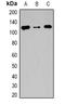 Teashirt Zinc Finger Homeobox 2 antibody, orb382468, Biorbyt, Western Blot image 