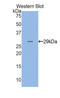 Adenosine Kinase antibody, LS-C292640, Lifespan Biosciences, Western Blot image 