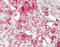 Interferon-induced protein with tetratricopeptide repeats 1 antibody, LS-B12059, Lifespan Biosciences, Immunohistochemistry frozen image 