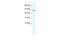 General Transcription Factor IIE Subunit 1 antibody, 31-216, ProSci, Western Blot image 