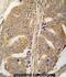 Paxillin antibody, abx032826, Abbexa, Immunohistochemistry paraffin image 