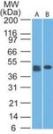 C-Type Lectin Domain Containing 9A antibody, NBP2-27087, Novus Biologicals, Western Blot image 