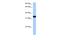 GTPase, IMAP Family Member 1 antibody, A11144, Boster Biological Technology, Western Blot image 