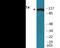 Nuclear Factor Of Activated T Cells 3 antibody, EKC2092, Boster Biological Technology, Western Blot image 