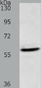 Acyl-CoA Thioesterase 2 antibody, TA322466, Origene, Western Blot image 