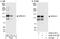 Sperm Antigen With Calponin Homology And Coiled-Coil Domains 1 antibody, A302-412A, Bethyl Labs, Immunoprecipitation image 