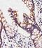 Sulfotransferase Hlo antibody, A10456-1, Boster Biological Technology, Immunohistochemistry paraffin image 
