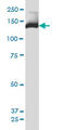 Phosphoinositide-3-Kinase Regulatory Subunit 4 antibody, LS-C133742, Lifespan Biosciences, Western Blot image 