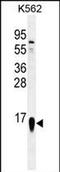 Ribosomal Protein S19 antibody, PA5-71623, Invitrogen Antibodies, Western Blot image 