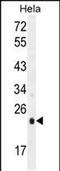 Ubiquinol-Cytochrome C Reductase, Rieske Iron-Sulfur Polypeptide 1 antibody, PA5-48253, Invitrogen Antibodies, Western Blot image 