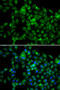 N-Acetyltransferase 8B (Putative, Gene/Pseudogene) antibody, 14-984, ProSci, Immunofluorescence image 