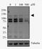 DNA Methyltransferase 3 Alpha antibody, NB120-13888, Novus Biologicals, Western Blot image 