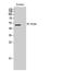 Phospholipase D Family Member 4 antibody, STJ94987, St John