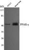 Peroxisome Proliferator Activated Receptor Gamma antibody, STJ98538, St John