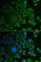 C1D Nuclear Receptor Corepressor antibody, 22-231, ProSci, Immunofluorescence image 