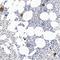 Integrin Subunit Alpha 2b antibody, NBP1-84581, Novus Biologicals, Immunohistochemistry paraffin image 