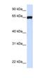 Leucine Rich Repeat Containing 4C antibody, orb325489, Biorbyt, Western Blot image 