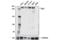 SWI/SNF Related, Matrix Associated, Actin Dependent Regulator Of Chromatin, Subfamily A, Member 4 antibody, 72182S, Cell Signaling Technology, Western Blot image 