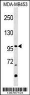 Nuclear Receptor Subfamily 3 Group C Member 2 antibody, 59-019, ProSci, Western Blot image 