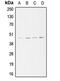 Actin Related Protein 3 antibody, MBS820231, MyBioSource, Western Blot image 