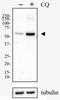 Sequestosome 1 antibody, NBP1-42822, Novus Biologicals, Western Blot image 