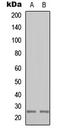 Calcium Binding Protein 7 antibody, LS-C358431, Lifespan Biosciences, Western Blot image 