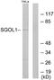 Shugoshin 1 antibody, A30456, Boster Biological Technology, Western Blot image 