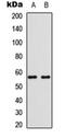 Bone Morphogenetic Protein 6 antibody, orb304703, Biorbyt, Western Blot image 