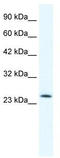 Transcription Factor 7 antibody, TA337703, Origene, Western Blot image 
