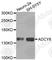 Adenylate Cyclase 8 antibody, A3582, ABclonal Technology, Western Blot image 
