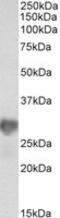 Nicotinamide N-Methyltransferase antibody, MBS423186, MyBioSource, Western Blot image 