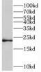 Transmembrane Protein 11 antibody, FNab08747, FineTest, Western Blot image 