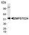 Zinc Metallopeptidase STE24 antibody, NB100-2387, Novus Biologicals, Western Blot image 