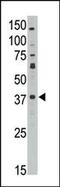 MAGE Family Member A10 antibody, 62-149, ProSci, Western Blot image 