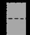 Tubulin Folding Cofactor B antibody, 201033-T38, Sino Biological, Western Blot image 