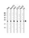 RAB7A, Member RAS Oncogene Family antibody, 63-577, ProSci, Western Blot image 