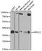 Protein Phosphatase 1 Catalytic Subunit Gamma antibody, GTX35235, GeneTex, Western Blot image 