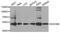 DExD-Box Helicase 39B antibody, A8356, ABclonal Technology, Western Blot image 