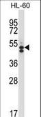 Histone Deacetylase 7 antibody, LS-C166824, Lifespan Biosciences, Western Blot image 