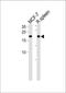 CCHC-Type Zinc Finger Nucleic Acid Binding Protein antibody, PA5-35241, Invitrogen Antibodies, Western Blot image 