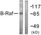 B-Raf Proto-Oncogene, Serine/Threonine Kinase antibody, LS-C117802, Lifespan Biosciences, Western Blot image 
