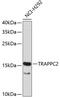 Trafficking Protein Particle Complex 2 antibody, 19-280, ProSci, Western Blot image 