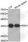 Partner Of NOB1 Homolog antibody, A3467, ABclonal Technology, Western Blot image 